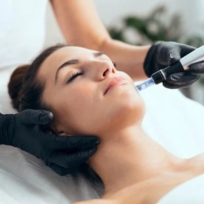 Microneedling